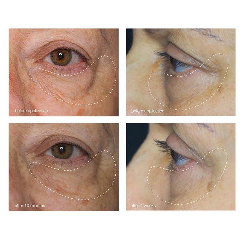 Awaken Peptide Eye Gel